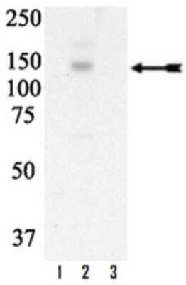 Western Blot: RNMT [p Tyr1003] Antibody [NBP2-29681]